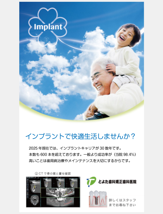 インプラントで快適生活しませんか？