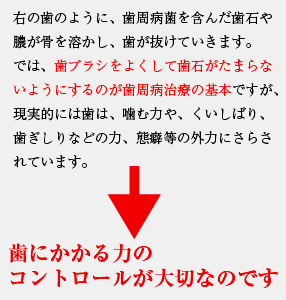 インプラント治療前
