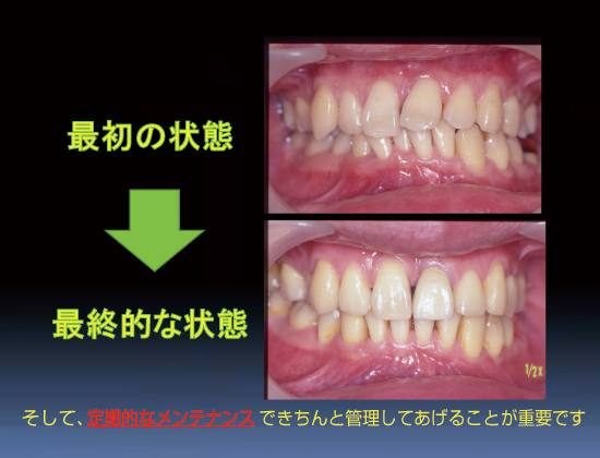 最初の状態・最終的な状態