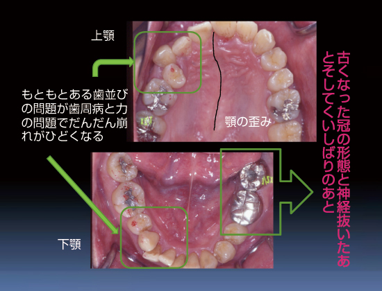 説明画像