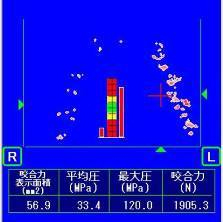 噛み合わせ・歯並び写真