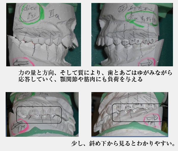 噛み合わせ・歯並び写真